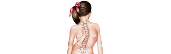 Scoliosis Surgery: The Complete Guide