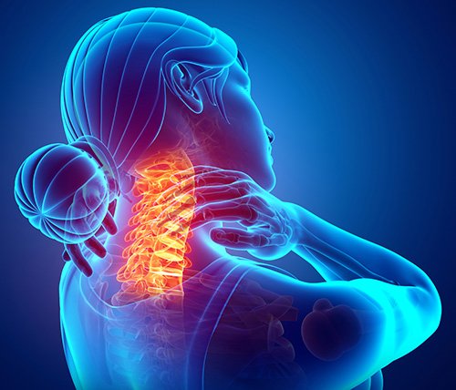 Preparing for Your Cervical Spinal Fusion