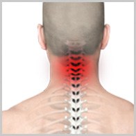 Neck Pain