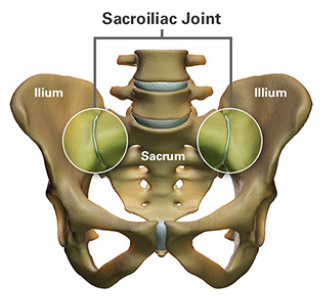 Sacroiliac Joint Pain  Novus Spine & Pain Clinic, Lakeland, Florida