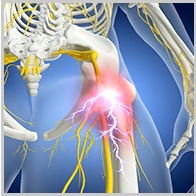 The Causes and Treatment of Sciatica Pain, by Sumitz Clinic